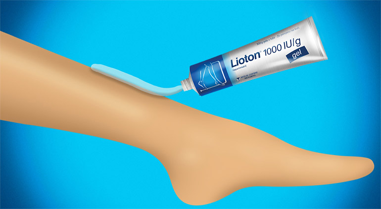 Primjena Lioton 1000 gela kod osjećaja težine u nogama 